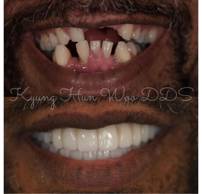 Woo Dental before-and-after smile transformation 3
