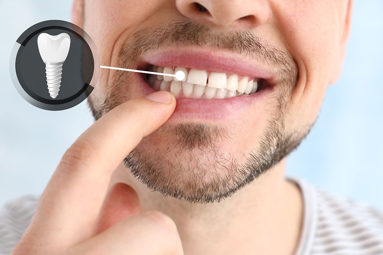 a man is pointing at his teeth with his finger .